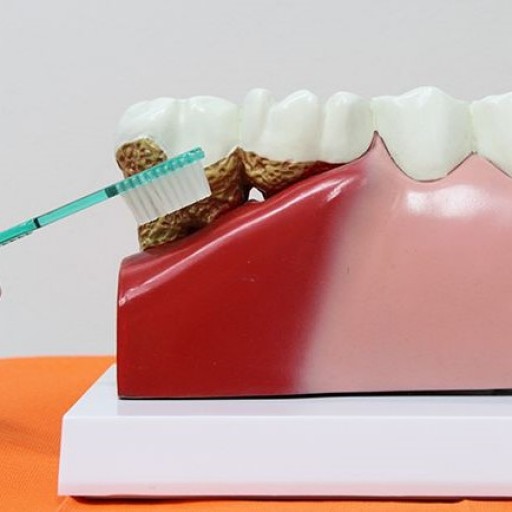Co jsou ustupující dásně? Jak tomu předejít?