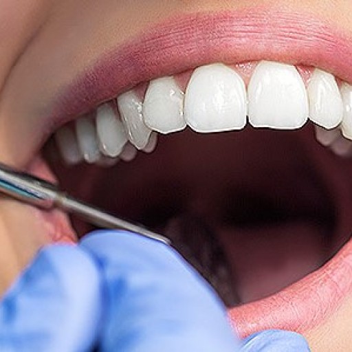 Zuby moudrosti – co je dobré o nich vědět? 